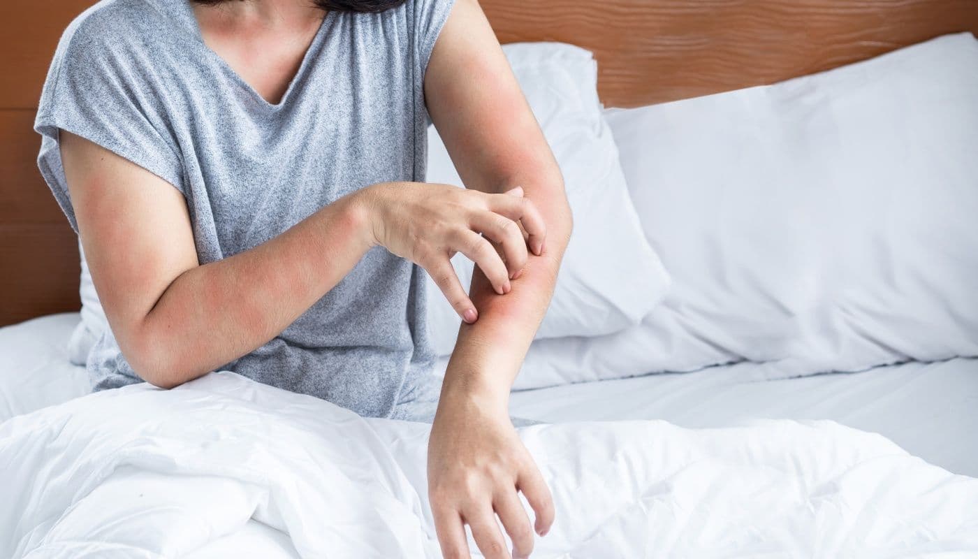 Menopause and Skin Rashes: Causes and How to Manage Them